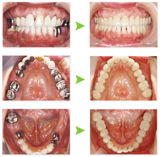 審美歯科治療 - 森永歯科クリニック（大阪市都島区）
